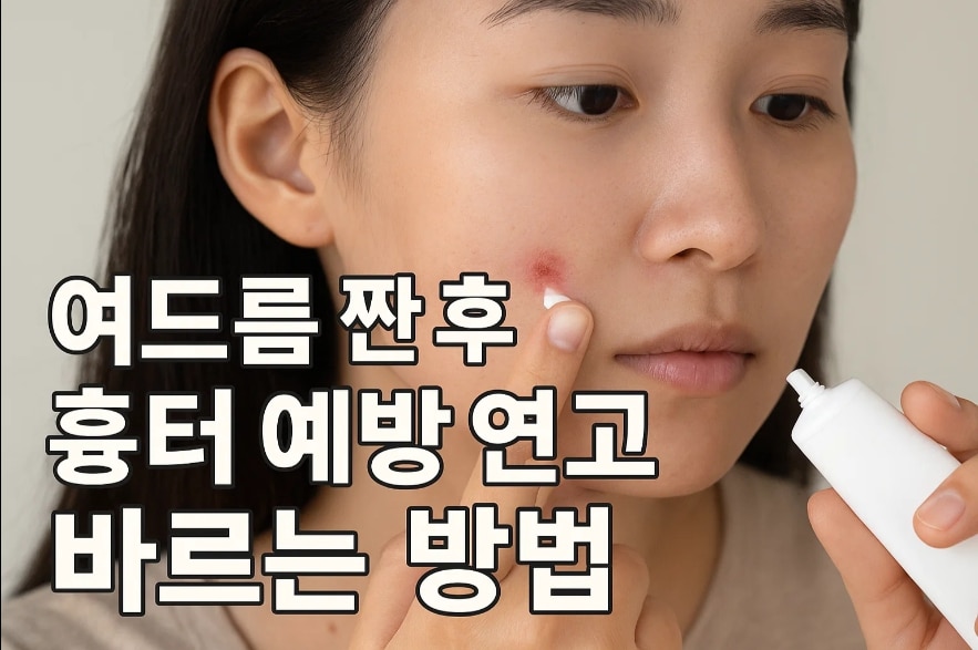 여드른 짜고 연고