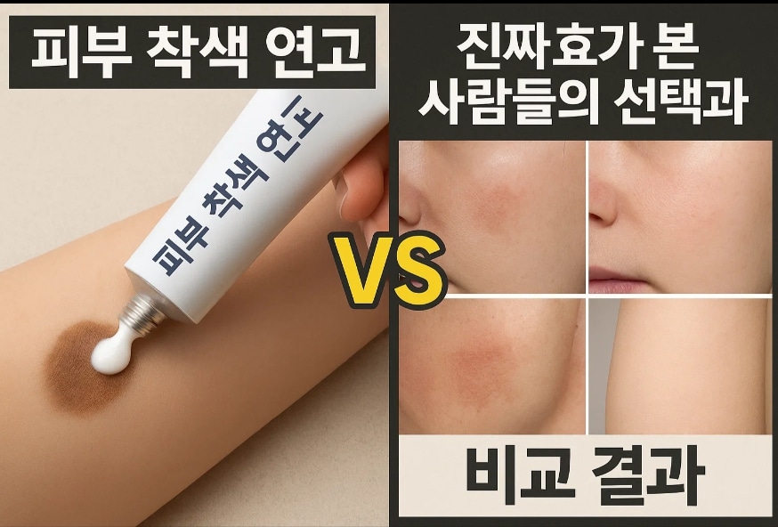 피부 착색 연고